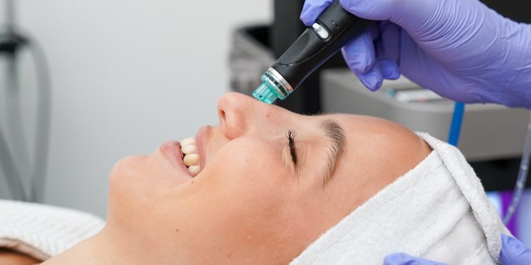 Extraction handpiece on the nose - blackhead removal in Vienna