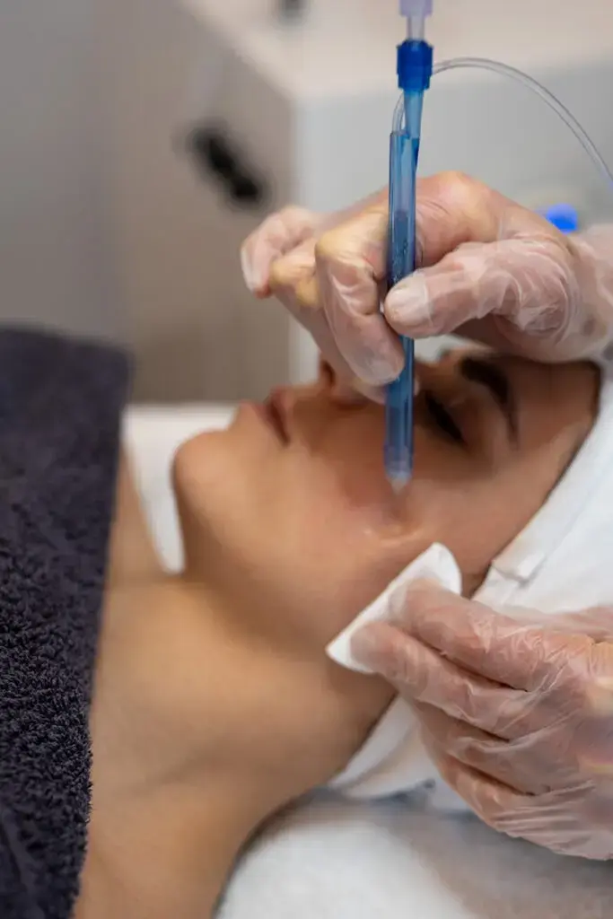 Gloved beautician guiding a blue JetPeel handpiece over a client's face while blotting with a tissue in Vienna