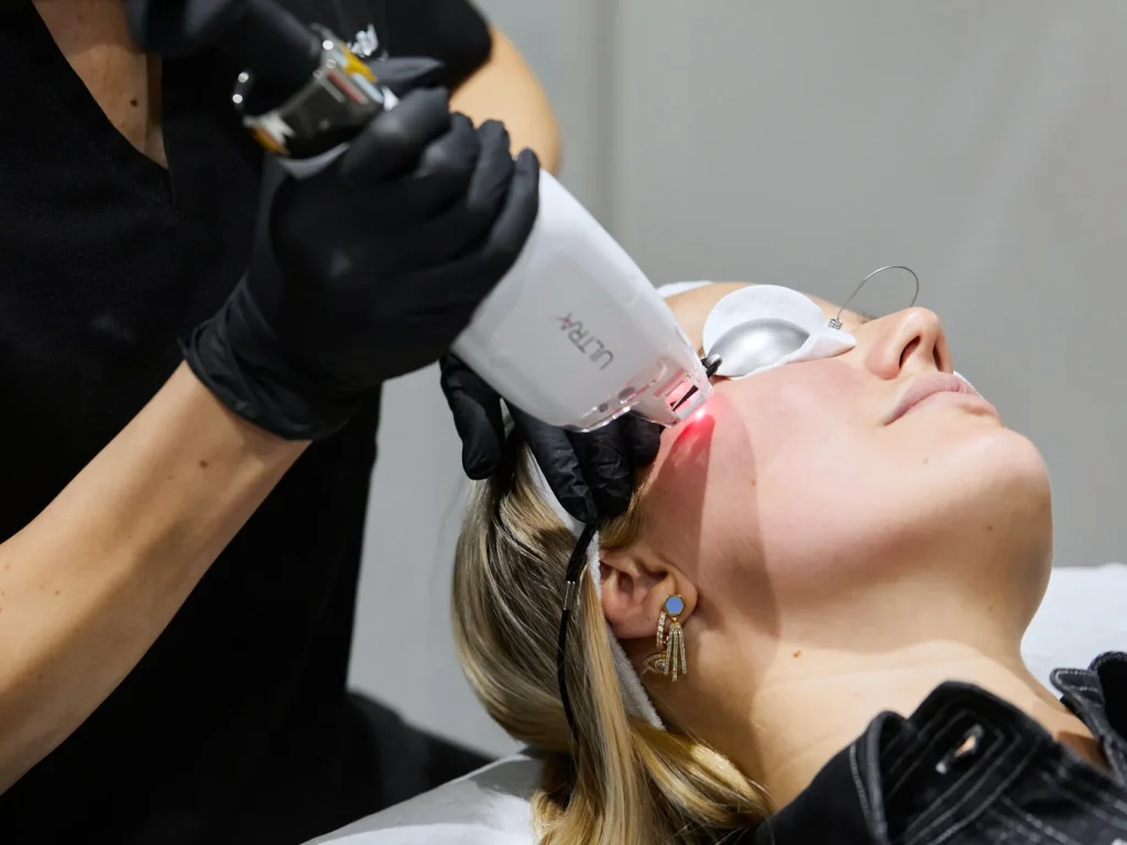 Laser facial treatment in Vienna: LaseMD handpiece with red light gliding over the cheek, eyes covered by laser shields