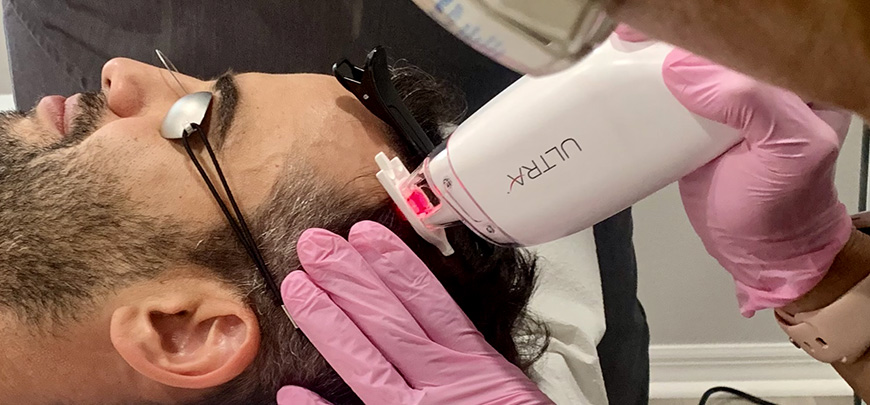 ULTRA laser handpiece on the face, client wearing laser safety glasses – laser facial in Vienna